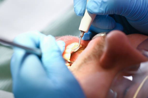 Best Emergency Root Canal Therapy in Mauldin, SC